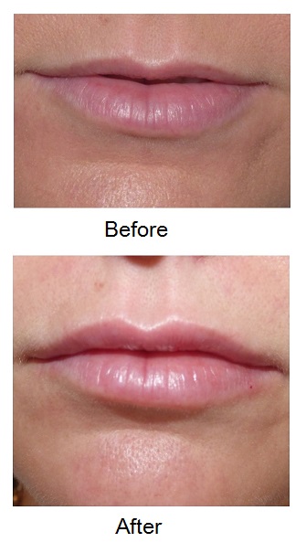 Front view of lips